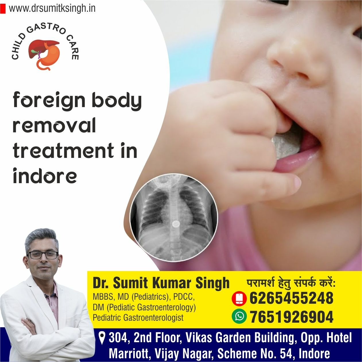Foreign Body Removal Treatment in Indore